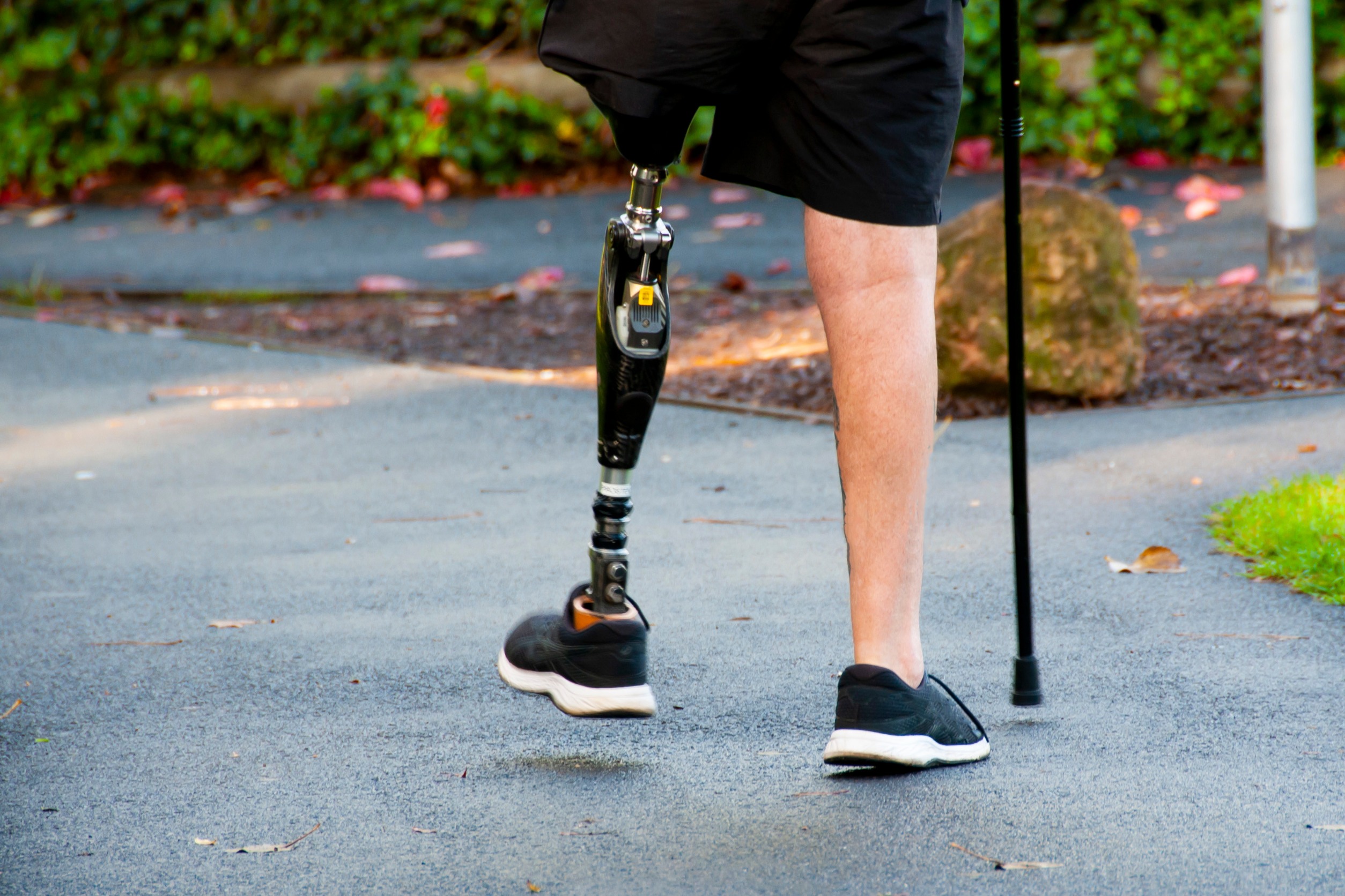 Bionic leg breakthrough: mind-