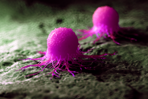 3d rendered medically accurate illustration of a cancer cell